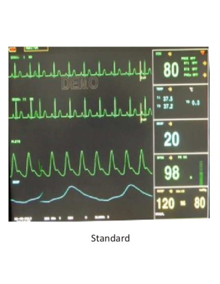 Scientech2365 TechBook for Multi-parameter Monitor