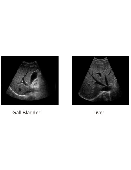 Scientech2364 Máquina de Ultrasonido Médico