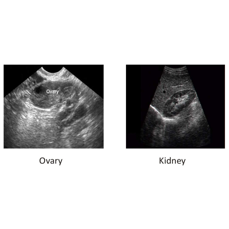 Scientech2364 Máquina de Ultrasonido Médico