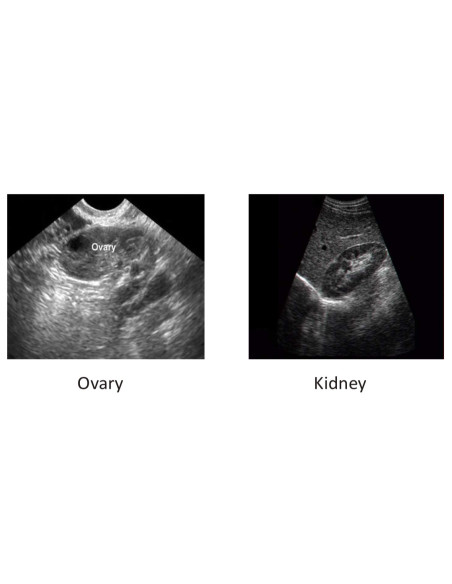 Scientech2364 Máquina de Ultrasonido Médico