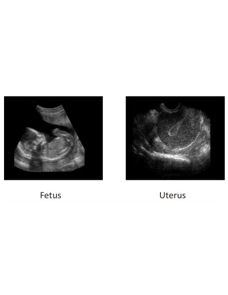 Scientech2364 Máquina de Ultrasonido Médico