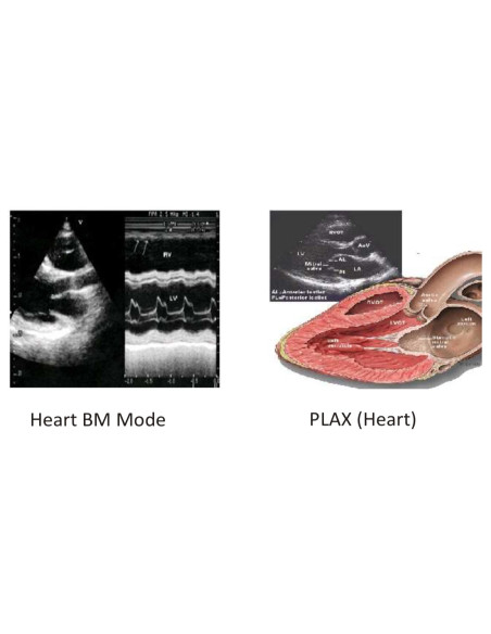 Scientech2364 Máquina de Ultrasonido Médico
