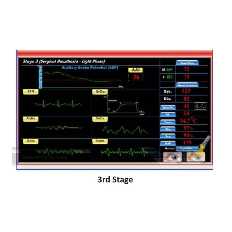 Scientech2363 TechBook para o Básico da Máquina de Anestesia