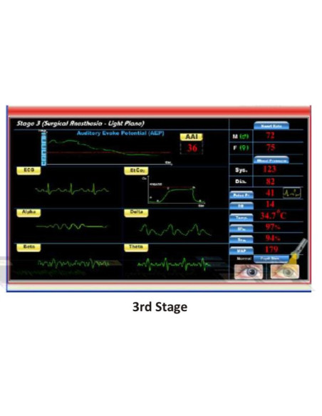 Scientech2363 TechBook para o Básico da Máquina de Anestesia