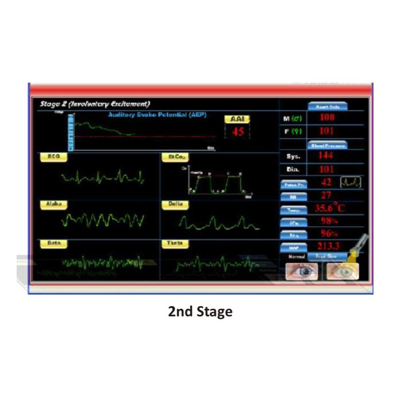 Scientech2363 TechBook para o Básico da Máquina de Anestesia