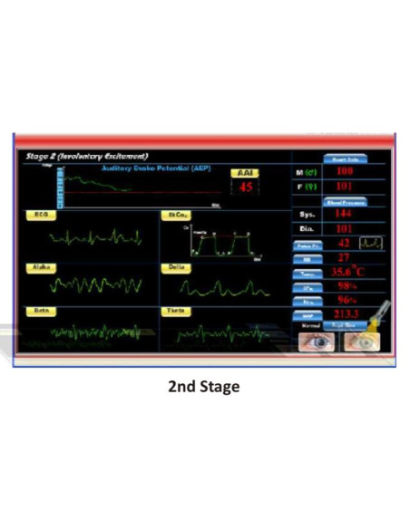 Scientech2363 TechBook para o Básico da Máquina de Anestesia