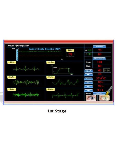 Scientech2363 TechBook para o Básico da Máquina de Anestesia