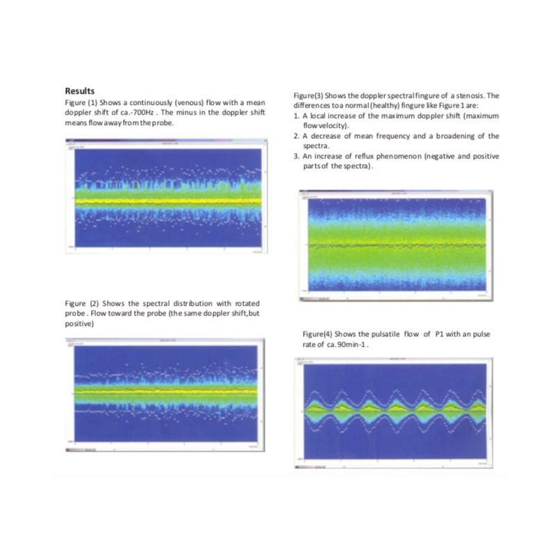 Scientech13E Sonografía Doppler