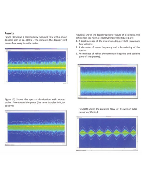 Scientech13E Doppler Sonography