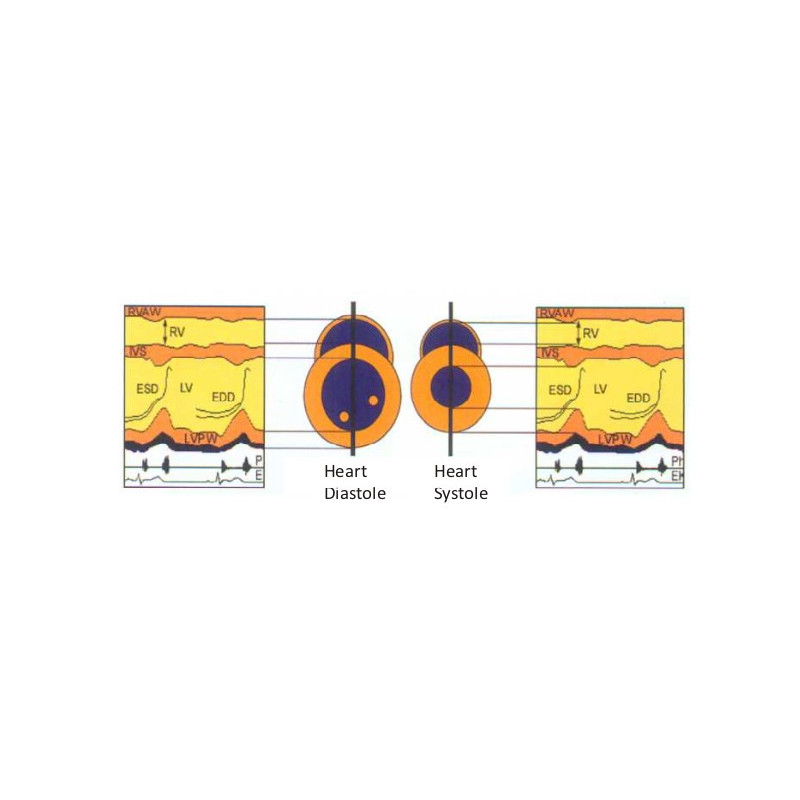 Scientech12E Ultrasonic T-M Mode