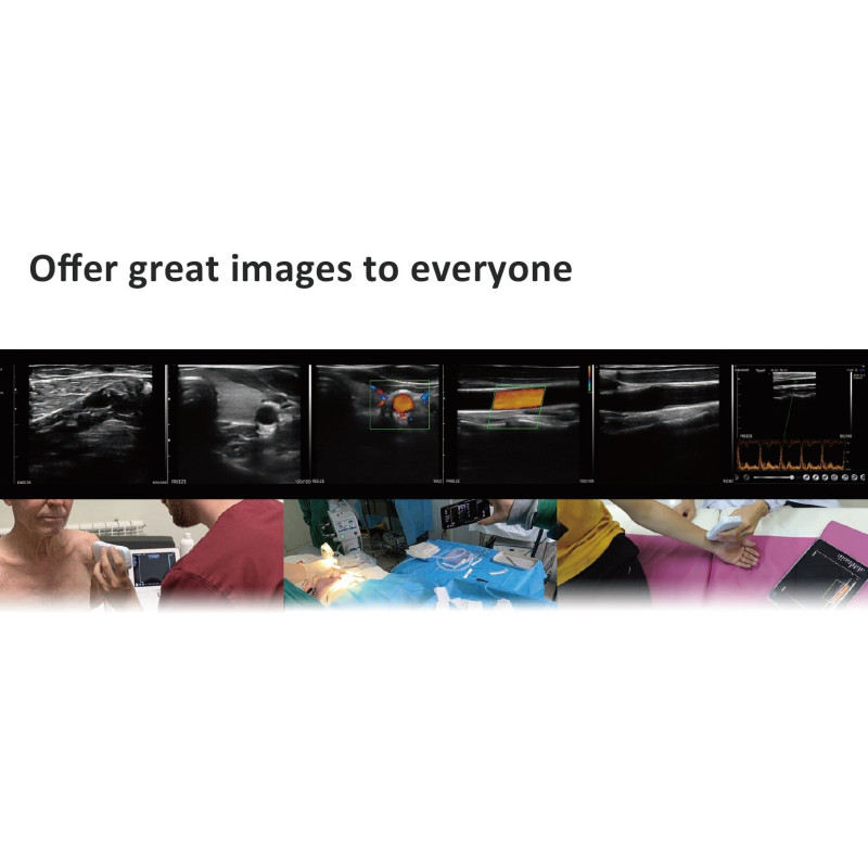 C10CX Color Doppler Linear Probe