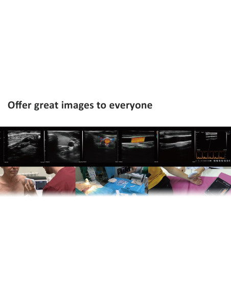 C10CX Color Doppler Linear Probe