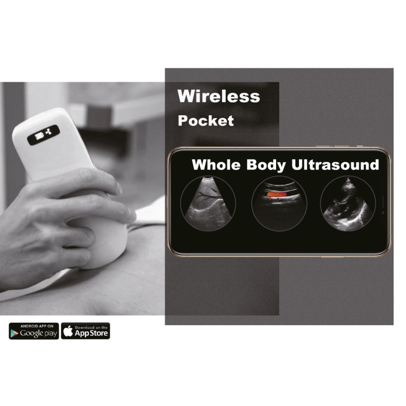 AO-C10T-3-in-1 Ultrasound Wireless Scanner - 5G
