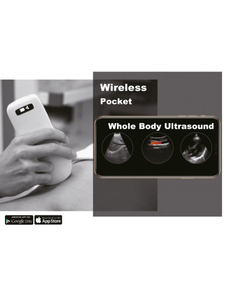 AO-C10T-3-in-1 Escáner de Ultrasonido inalámbrico - 5G