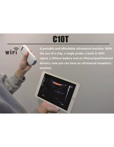 AO-C10T-3-in-1 Ultrasound Wireless Scanner - 5G