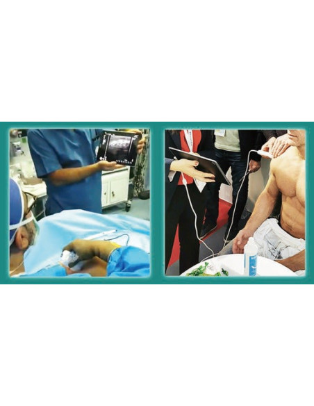 C10RL  Dual head wireless & USB probe