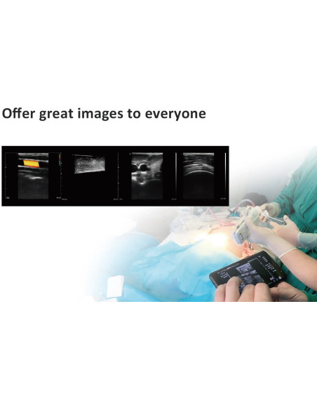 C10CS High Frequency Linear Color Dopler