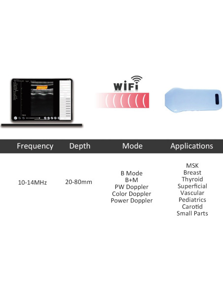 C10CS Scanner WIFI Doppler Linear Colorido de Alta Frequência