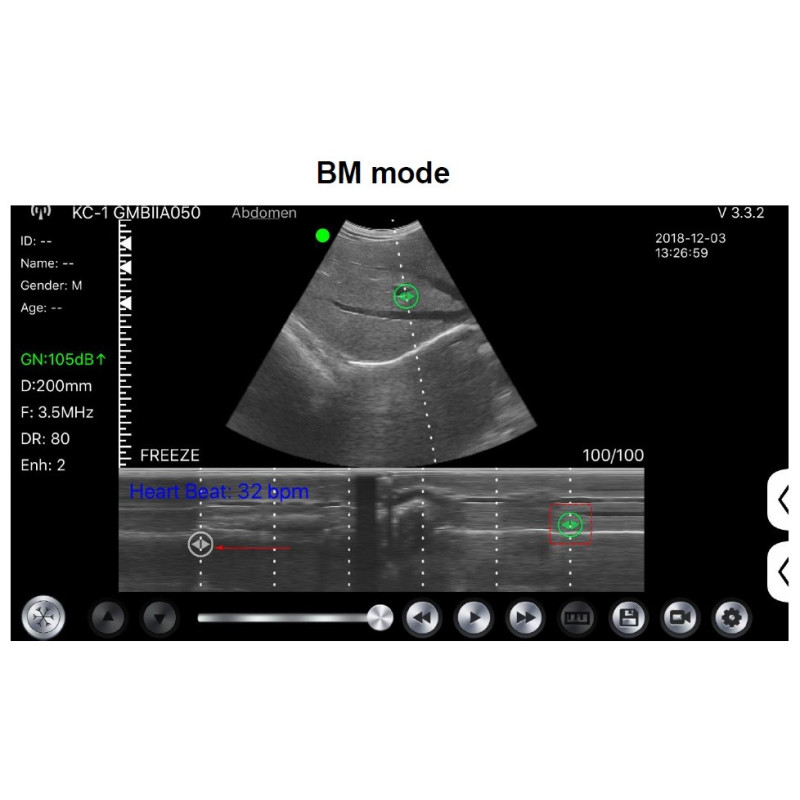 C10CS Scanner WIFI Doppler Linear Colorido de Alta Frequência