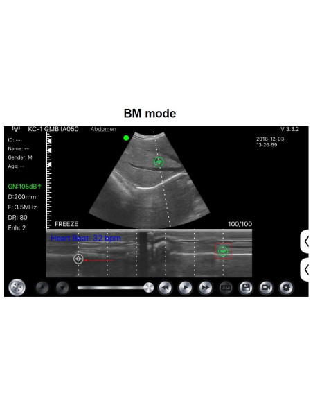 C10CS Scanner WIFI Doppler Linear Colorido de Alta Frequência