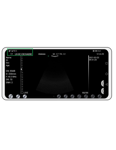 A sonda foi conectada com sucesso ao celular. O “UX-8C" é exibido na interface do APP
