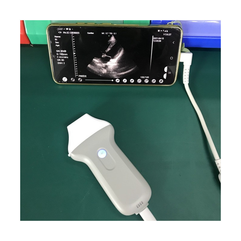 Professional phased array Probe, Wifi/USB connection with iOS, Android & Windows, C10UC
