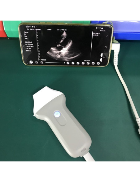 Professional phased array Probe, Wifi/USB connection with iOS, Android & Windows, C10UC