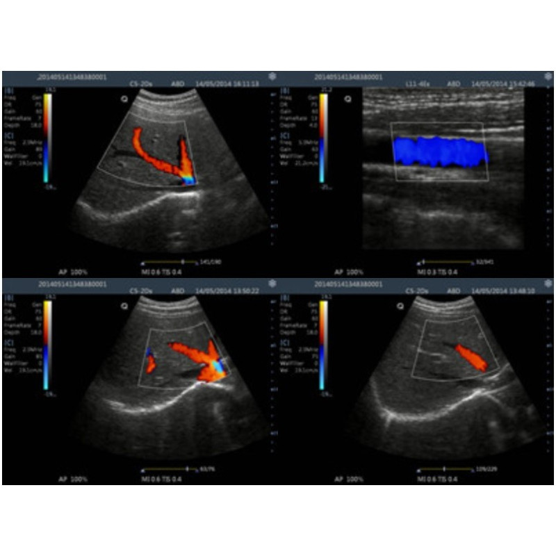 Sonda corporal C3 ultrasonido Doppler color con 3 conectores de sonda