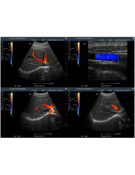 Sonda corporal C3 ultrasonido Doppler color con 3 conectores de sonda