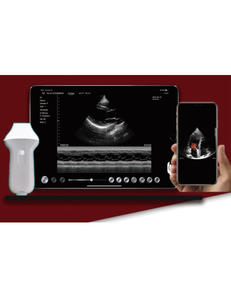 Professional phased array Probe, Wifi/USB connection with iOS, Android & Windows, C10UC