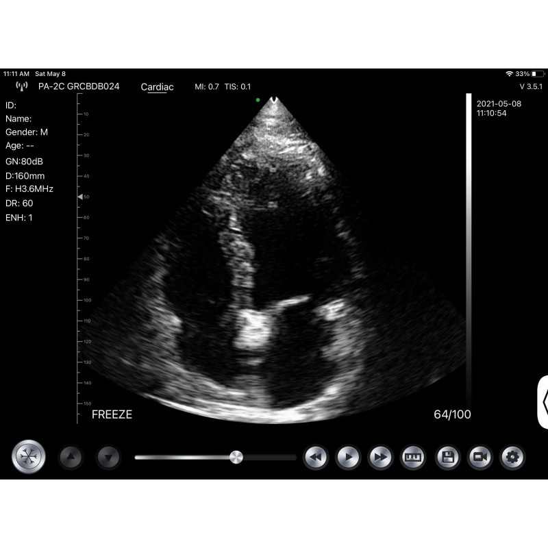 Professional phased array Probe, Wifi/USB connection with iOS, Android & Windows, C10UC