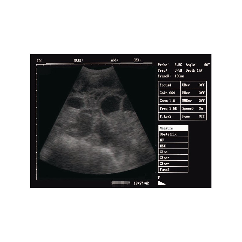 V10 The newest veterinary ultrasound scanner is high-end machine. 7 inch screen ,waterproof ,Used for various animals