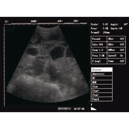 V10 The newest veterinary ultrasound scanner is high-end machine. 7 inch screen ,waterproof ,Used for various animals