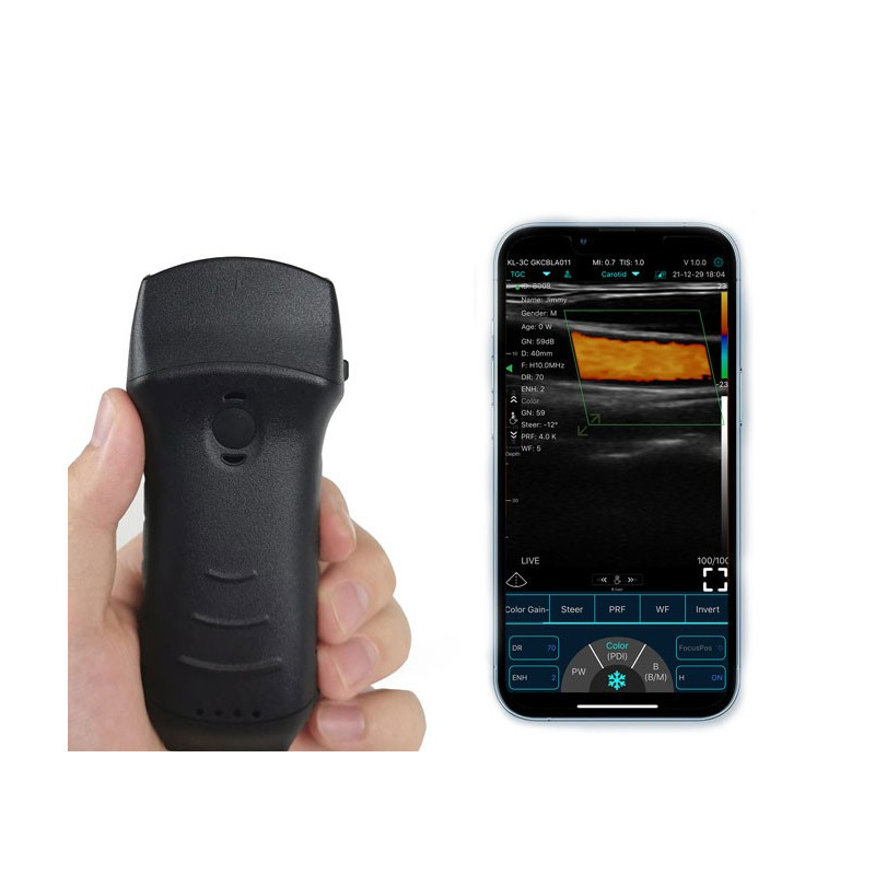 Konted C10TX Sonda dual ultrasónica Multiuso convexa + lineal + escaner cardíaco