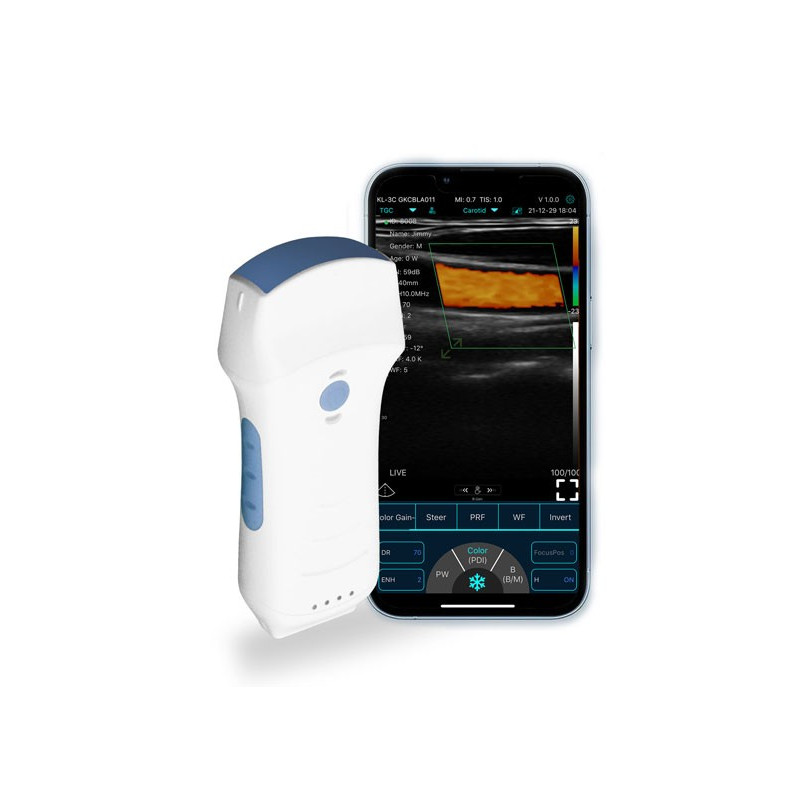 Konted C10TX Nova Sonda Dupla Multiuso Ultrassom Convexa + Linear + Sonda Cardíaca
