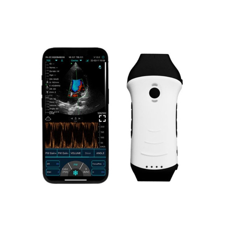 Konted C10HL Dual-probes Multipurpose Ultrasound Phased + Linear Probe