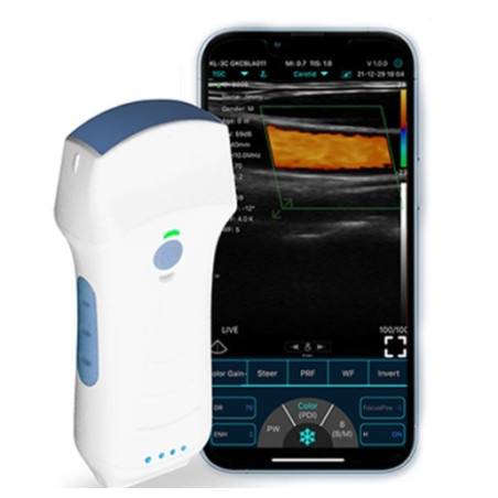 Konted C10TX Sonda dual ultrasónica Multiuso convexa + lineal + escaner cardíaco