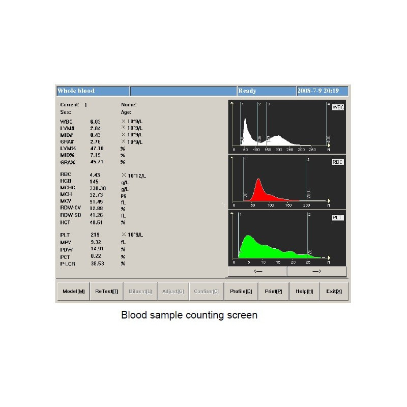 HA-17600 Medical Hematology Analyzer