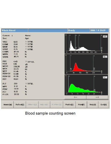 HA-17600 Medical Hematology Analyzer