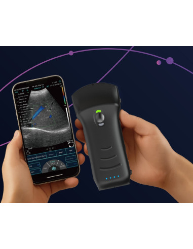 Escáner de ultrasonido inalámbrico mejorado, sondas duales, ultrasonido multipropósito, sonda convexa + lineal + cardíaca