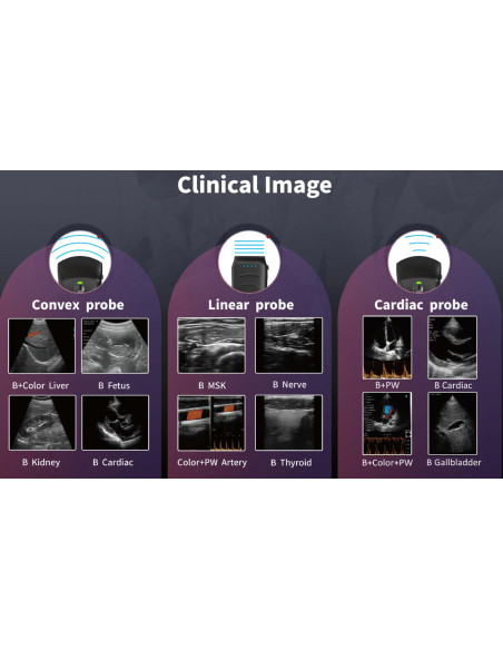 Escáner de ultrasonido inalámbrico mejorado, sondas duales, ultrasonido multipropósito, sonda convexa + lineal + cardíaca