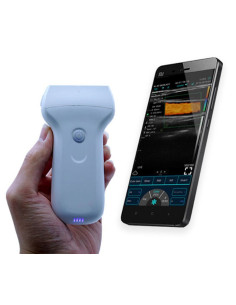 Sonda linear de ultrassons superficiais a cores USB e Wi-Fi, C10UL 2