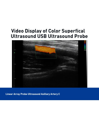 Color Superficial Ultrasound USB & Wifi Linear Probe, C10UL
