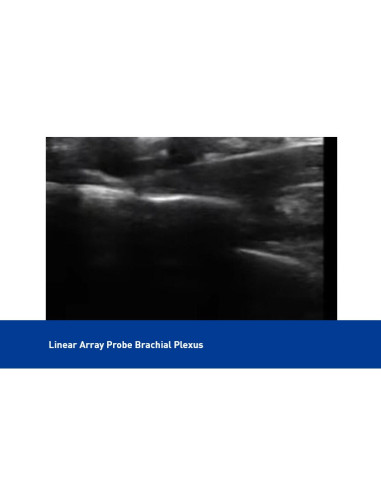 Sonda lineal de ultrasonido superficial a color USB y Wifi, C10UL