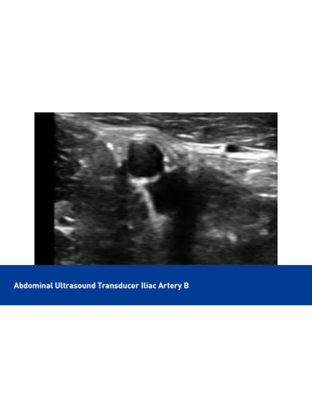 Color Superficial Ultrasound USB & Wifi Linear Probe, C10UL