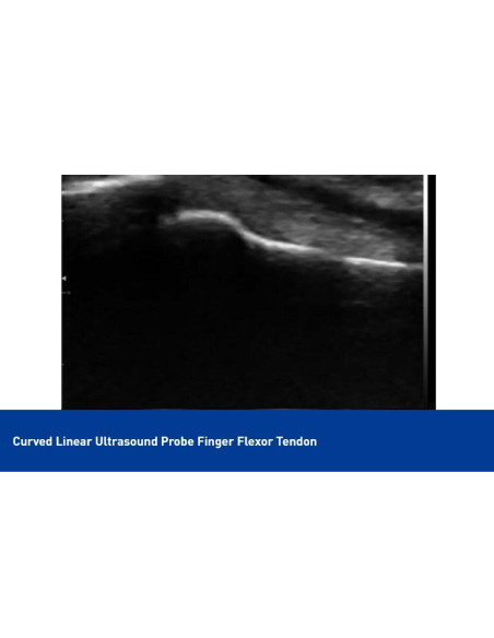 Color Superficial Ultrasound USB & Wifi Linear Probe, C10UL