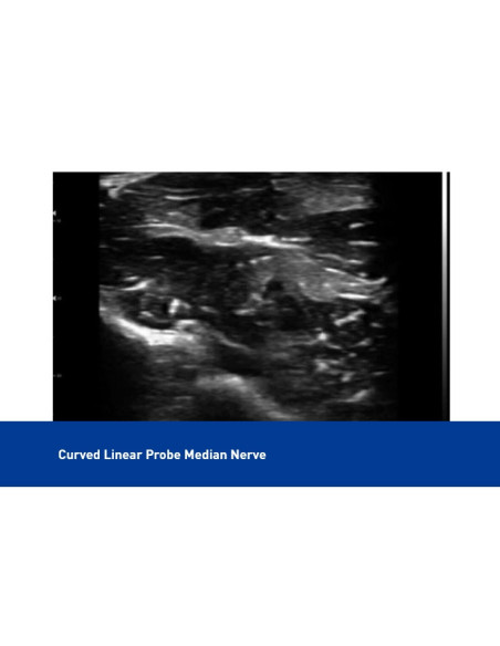 Sonda lineal de ultrasonido superficial a color USB y Wifi, C10UL