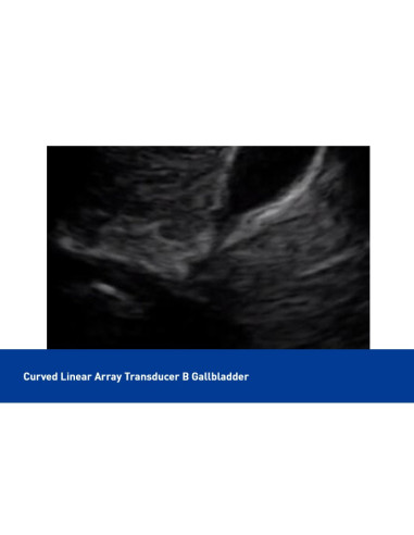 Color Superficial Ultrasound USB & Wifi Linear Probe, C10UL