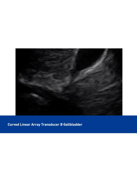 Color Superficial Ultrasound USB & Wifi Linear Probe, C10UL